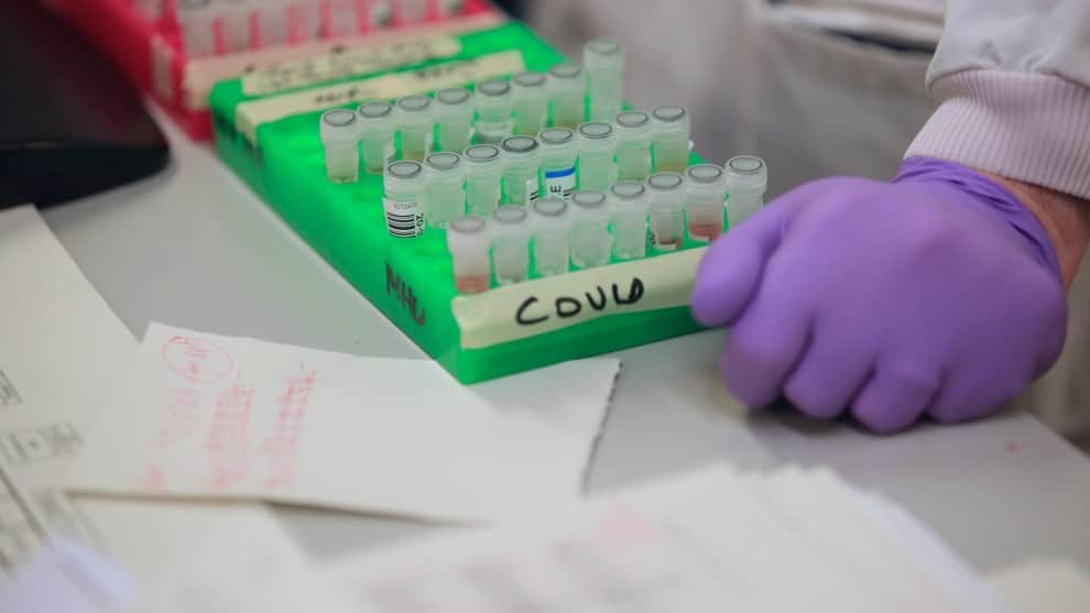 Photo of Asciende a 31 el número de contagiados por coronavirus en Córdoba