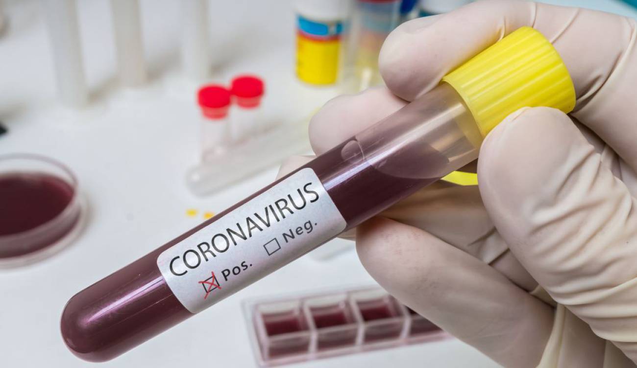 Photo of A 78 ascienden los casos de coronavirus en Córdoba