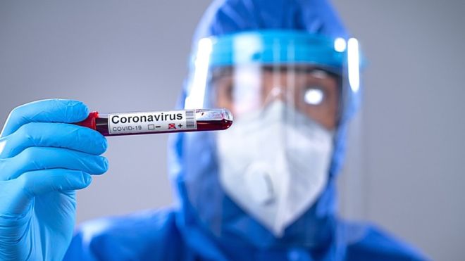 Photo of Se disparan casos de COVID-19 en Córdoba. Reportan 26 nuevos contagiados