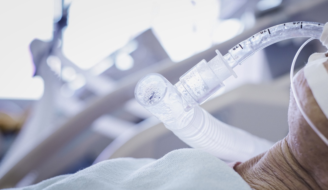 Photo of Se registra la séptima víctima mortal por coronavirus en Córdoba