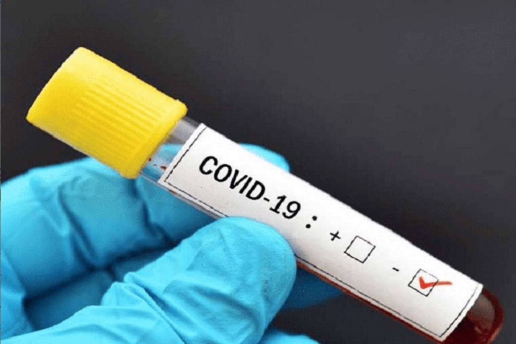 Photo of En Córdoba se han descartado más de 2.000 casos sospechosos de coronavirus