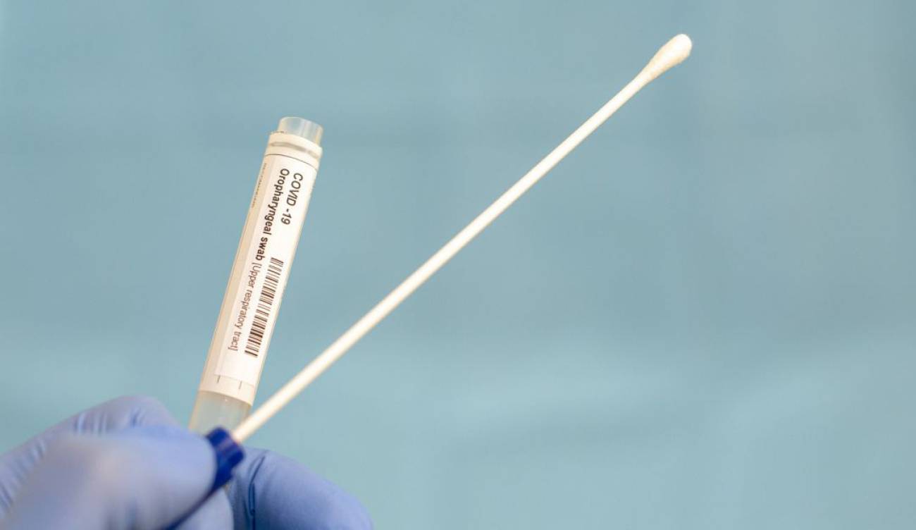 Photo of MinSalud establecería en $216.994 el precio de prueba diagnóstica de COVID