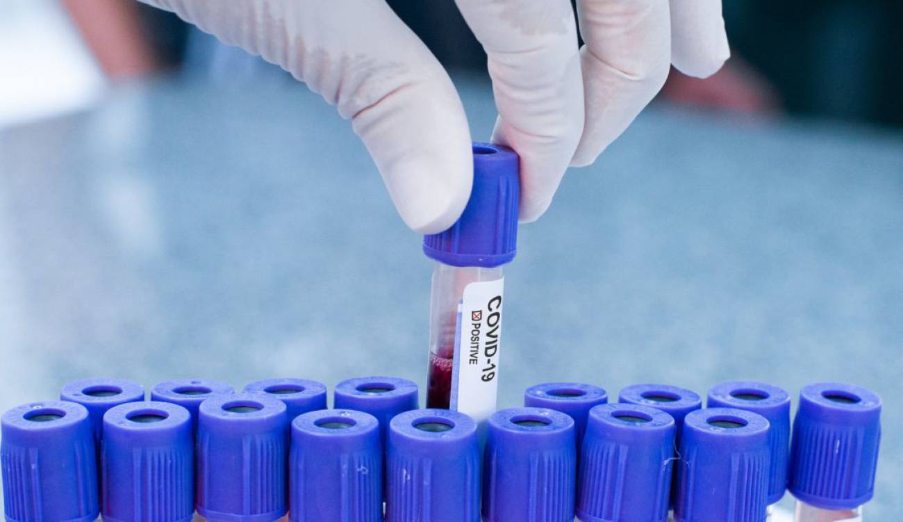 Photo of Laboratorio chino podría detener la pandemia «sin necesidad de vacuna»
