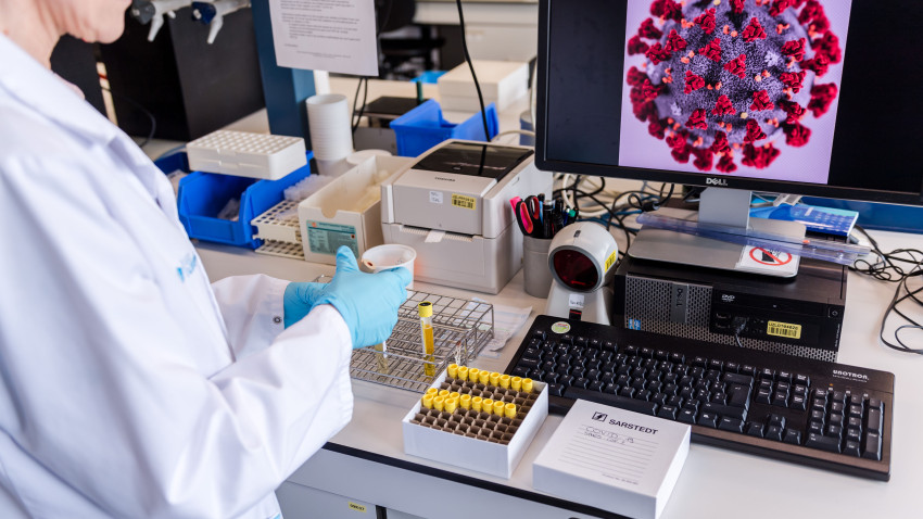 Photo of Identifican en Córdoba la variante californiana del Covid-19