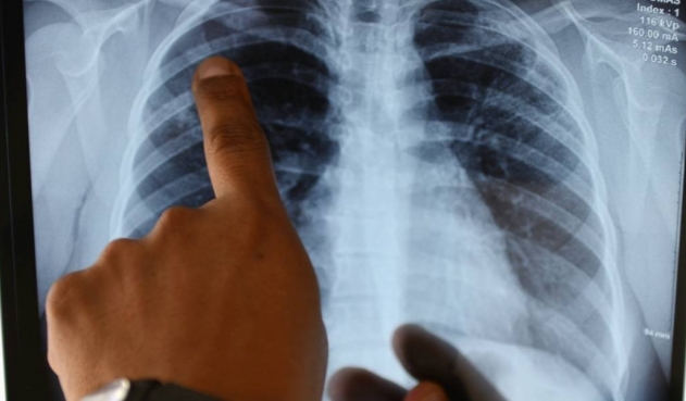 Photo of Científico descubre droga que podría eliminar COVID-19 de pulmones en pocos días