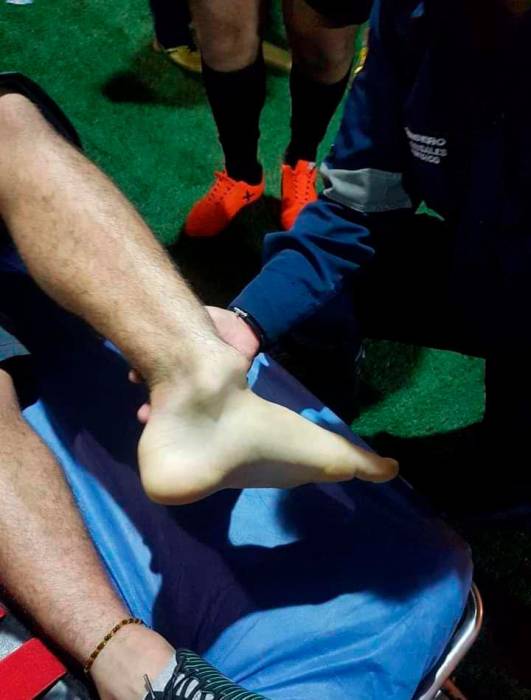 Photo of Imagen de tobillo lesionado en redes no es de Santiago Arias