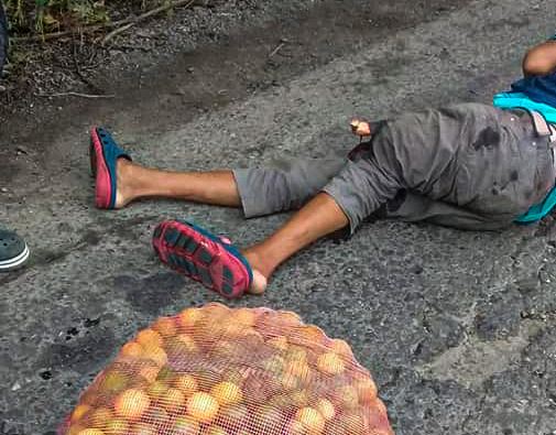 Photo of Vendedor de limón resultó fracturado tras accidentarse en la vía La Apartada – Montelíbano