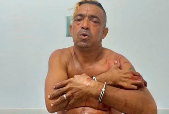 Photo of Un muerto y un capturado dejó pelea entre amigos por 5 mil pesos que encontraron en la calle