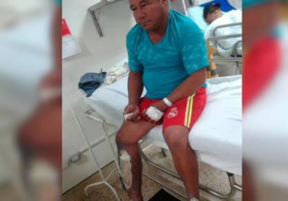 Photo of Por celos, mujer quemó a su marido con agua hirviendo