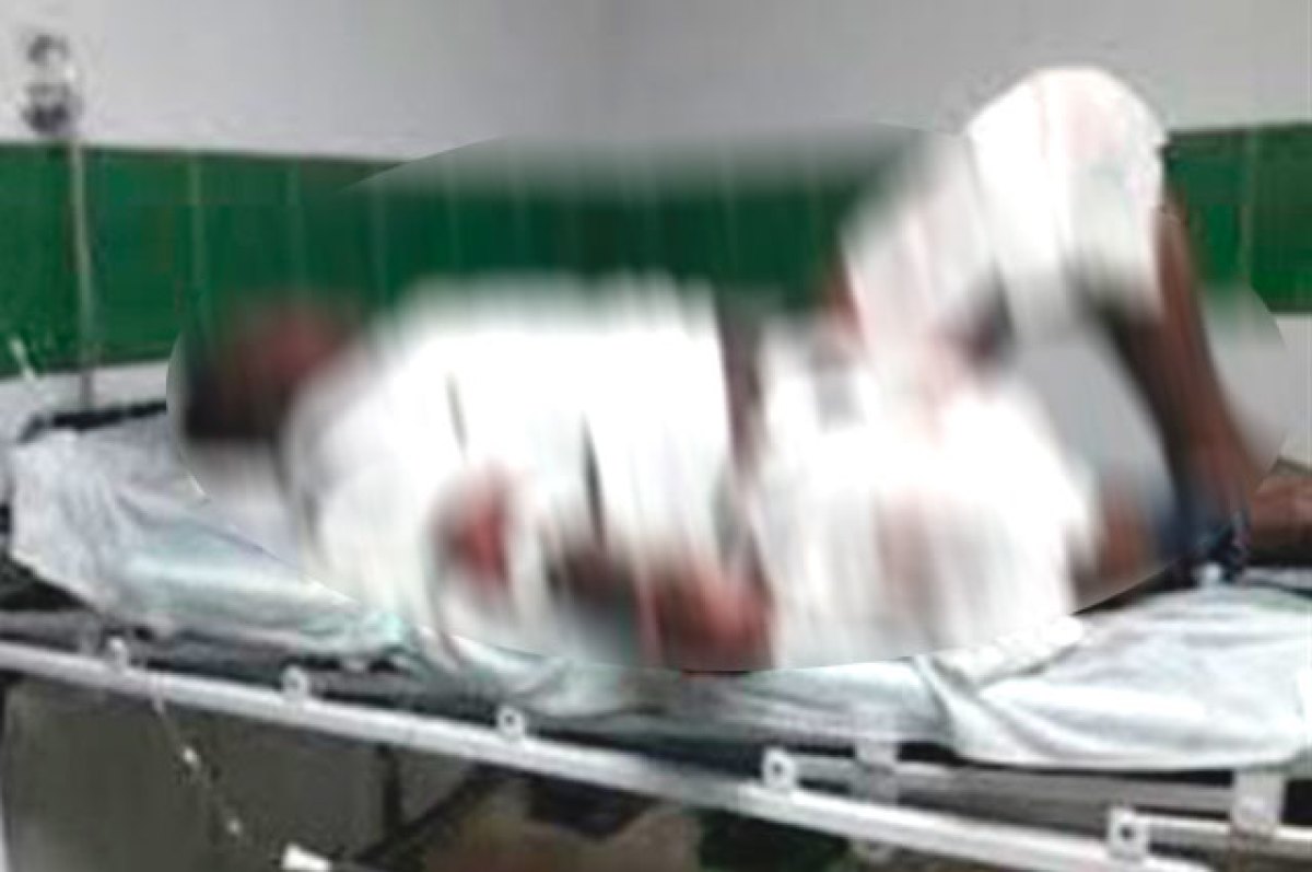 Photo of Mecánico muere tras sufrir quemaduras cuando reparaba un carro en Pueblo Nuevo