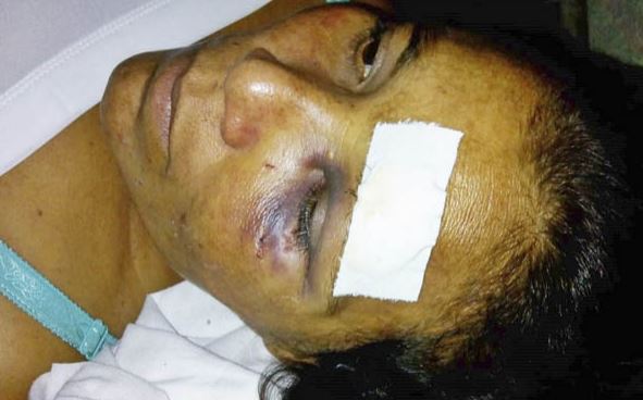 Photo of El marido la agredió porque no quiere que la familia de ella la visite