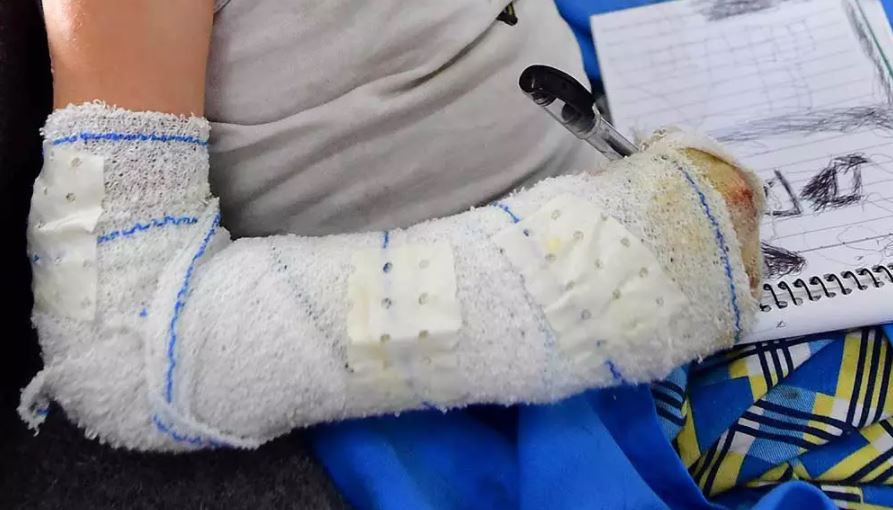 Photo of Mujer quemó a sus hijos gemelos de 7 años con aceite caliente «para reprenderlos» en Sincelejo
