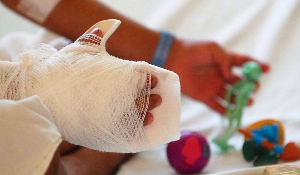 Photo of Cifra de quemados con pólvora ascendió a 878 casos entre 2021 y el inicio de 2022