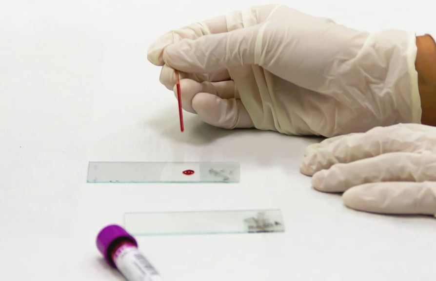 Photo of Descubren nueva variante del VIH: es más contagiosa y virulenta