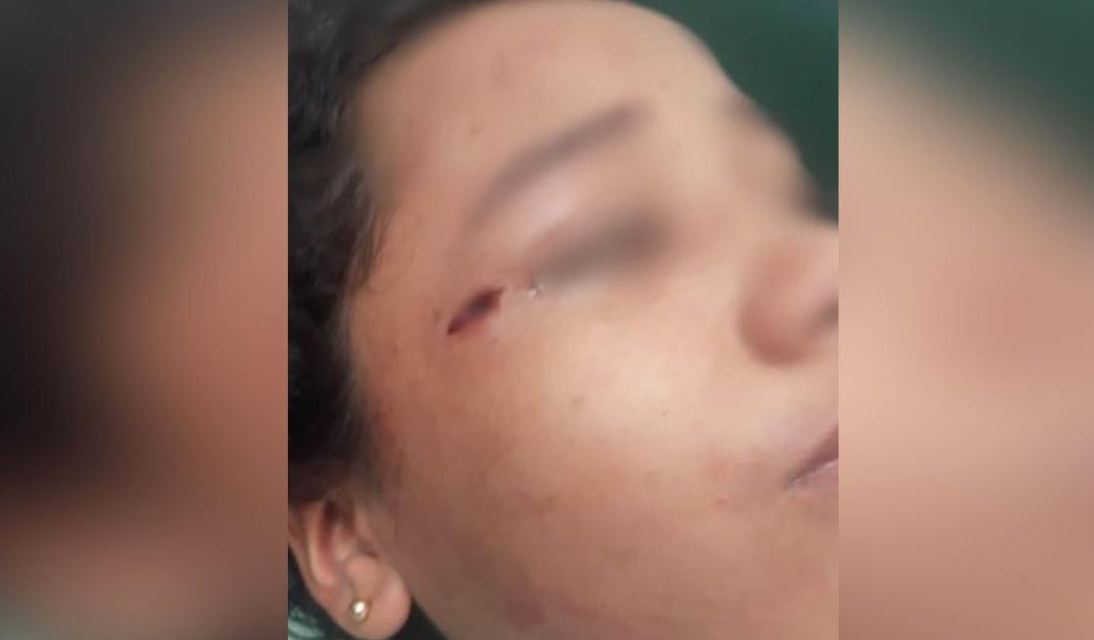 Photo of Una menor resultó herida tras caerle un ventilador en colegio de Montería