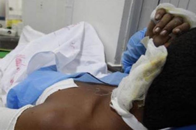 Photo of Mujer le prendió fuego a su pareja porque llegó amanecido