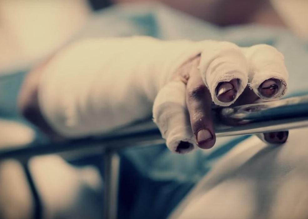 Photo of En Sahagún, reportan el primer quemado con pólvora en Córdoba. En el país van 74 casos