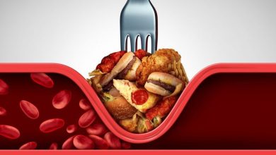 Photo of Un colesterol alto mal tratado puede causar infarto ¿cómo se podría controlar?