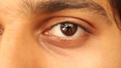 Photo of Cuidado, la falta de esta vitamina es la que le causa las ojeras