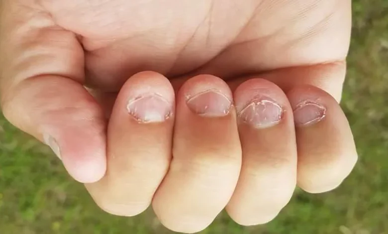 Técnicas de autocuidado para manos y uñas.