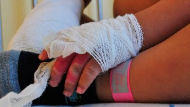 Photo of Reportan menores quemados con pólvora en Planeta Rica y Montelíbano