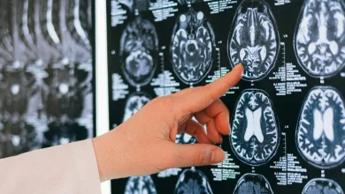 Photo of Microplásticos en el cerebro: una amenaza invisible que crece rápidamente