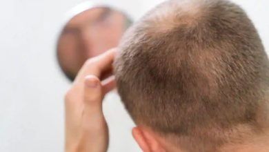 Photo of ¿Cómo combatir la alopecia sin cirugía? Estos son los nuevos avances