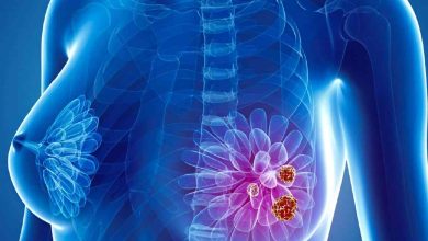 Photo of Nuevo hallazgo en cáncer de mama: descubren cómo frenar la metástasis antes de que comience