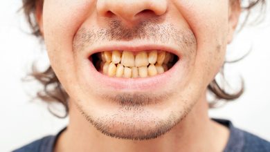 Photo of Más allá del blanco: lo que el color de tus dientes revela sobre tu salud