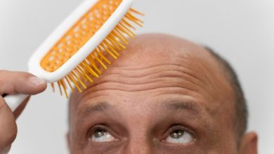 Photo of Colombia, entre los países con más calvos del mundo