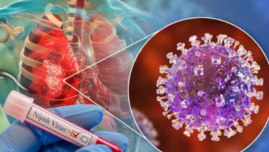 Photo of Alerta en India por el virus Nipah: ¿Podría llegar a Colombia?