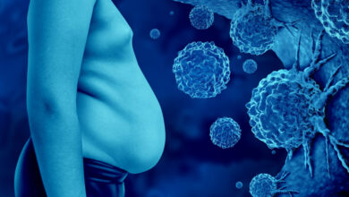 Photo of Sobrepeso y obesidad elevan el riesgo de al menos 13 tipos de cáncer, advierten estudios científicos