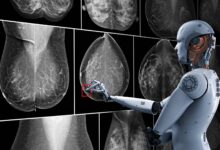 Photo of Inteligencia artificial creada en Colombia detecta cáncer de mama en menos de un minuto